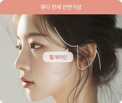 큐디 전체 안면거상