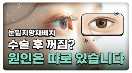 눈밑지 수술 후 꺼짐? 원인은 따로 …