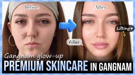 Skincare Glow-up in …
